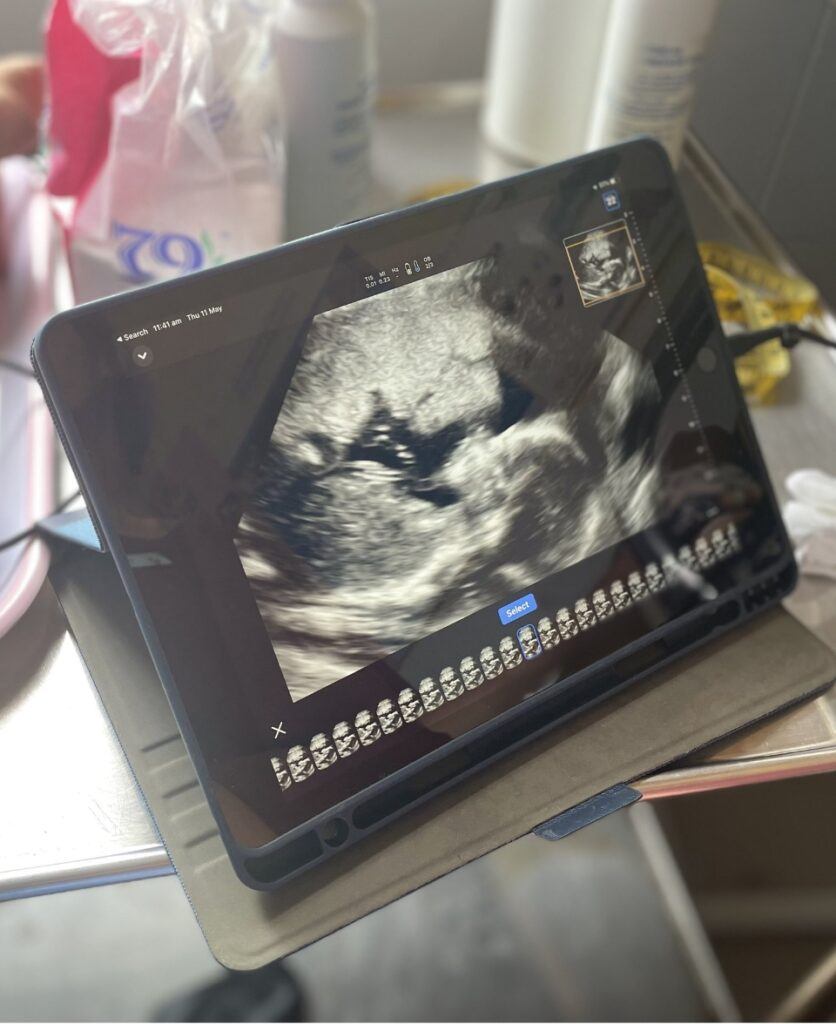 ultrasound-check